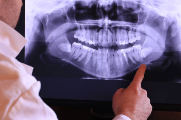Best Emergency Tooth Extraction  in Goddard, KS